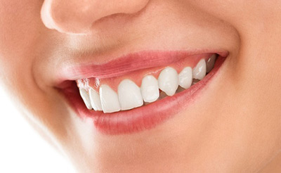 چه خوراکیهایی برای تقویت لثه مفیدند، تحلیل رفتن لثه ها بیماری پریودنتال , مشکلات دهان و دندان