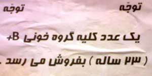 فروش کلیه,احکام فروش کلیه فروش کلیه,احکام فروش کلیه