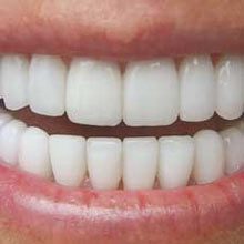 این 5 نشانه را جدی بگیرید, دندان درد