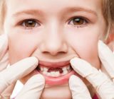 مشکل های رایج رویش دندان های دائمی در کودکان, بچه, بچه داری, تربیت فرزندان, فرزند, فرزندان, کودک, کودکیاری, نکات تربیتی