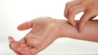 حساسیت پوستی،حساسیت پوستی در کودکان حساسیت پوستی خارش