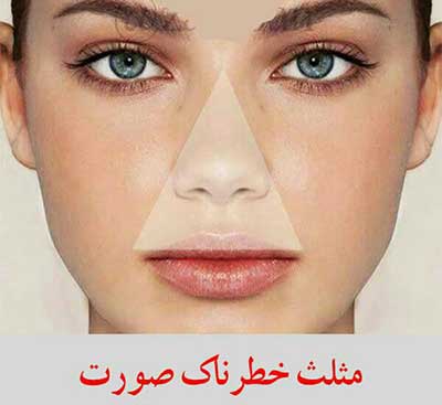 جوش صورت،درمان جای جوش صورت از بین بردن جوش صورت