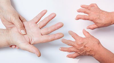 غذاهای مفید برای آرتروز، تغذیه مناسب برای آرتروز درمان آرتروز با تغذیه, مواد غذایی مفید برای آرتروز
