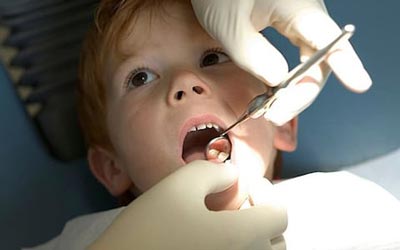 مهم‌ترین عامل پوسیدگی دندان در کودکان, فرزندان