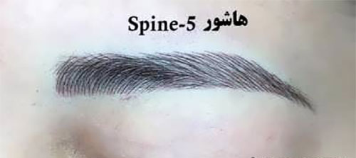 فیبروز ابرو؛ انواع و هزینهی آن فیبروز ابرو؛ انواع و هزینهی آن