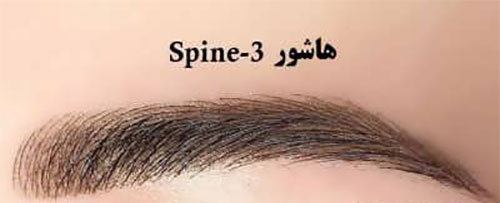 فیبروز ابرو؛ انواع و هزینهی آن فیبروز ابرو؛ انواع و هزینهی آن